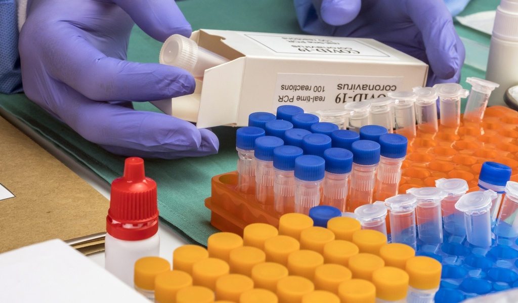 Osteocalcin Elisa Assay